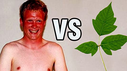 Sunburn vs Poison Ivy